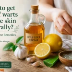 How to get rid of warts on the skin naturally? simple home 9 remedies